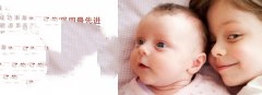 精子是否健康要这样判断