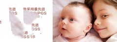 为什么会出现空卵泡